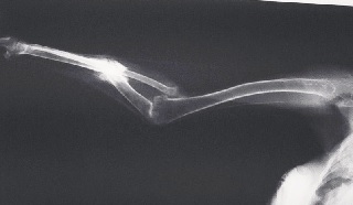 x-ray.jpg
